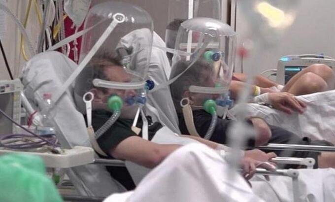Entübe Hasta Ne Demek? Türkiye’de Entübe Hasta Sayısı Kaça Yükseldi?