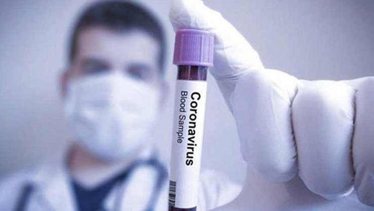Uzmanlar: “Coronavirus Salgını İçin Önümüzdeki İki Ayı Çok İyi Değerlendirmemiz Lazım”